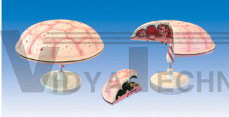 The model of placenta and umbilical cord (2parts)